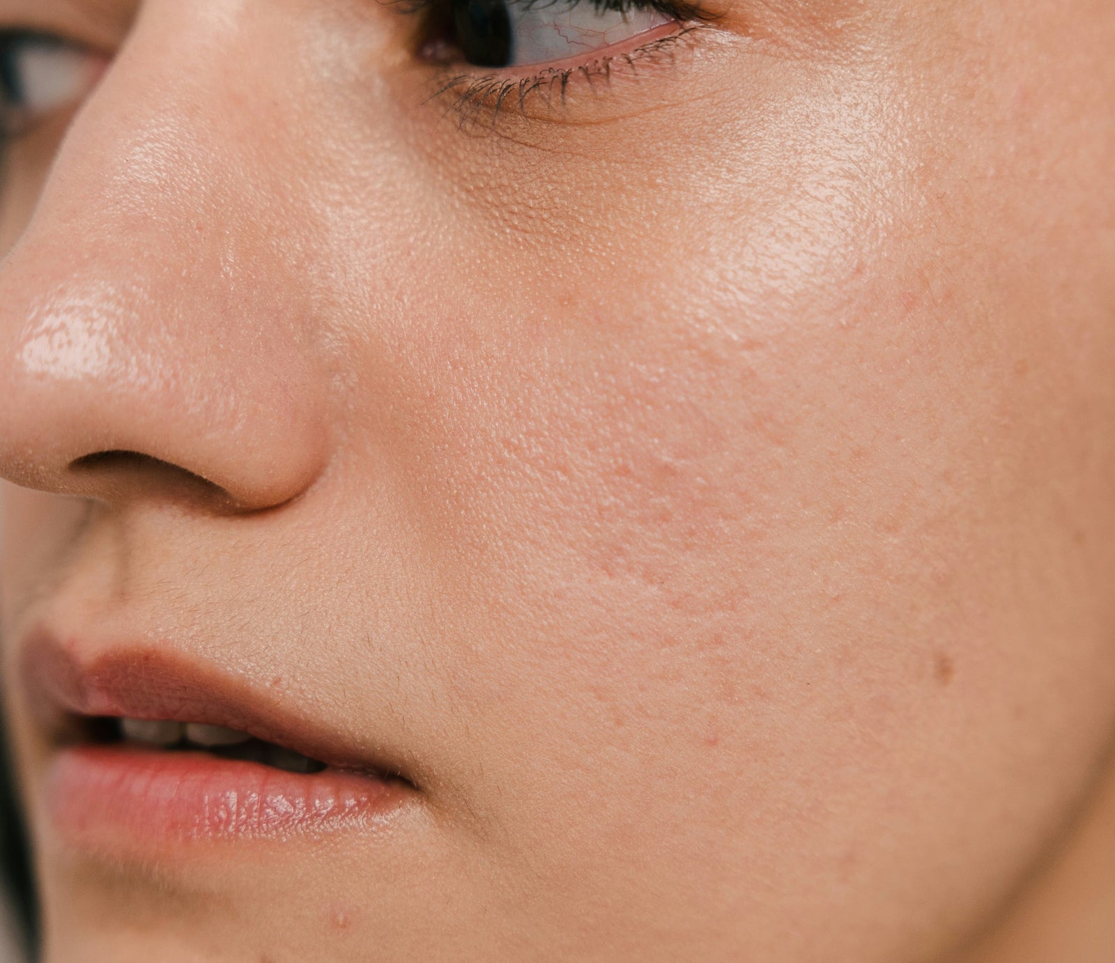 Damaged Skin Barrier? How to Strengthen, Protect, and Renew Your Skin Barrier