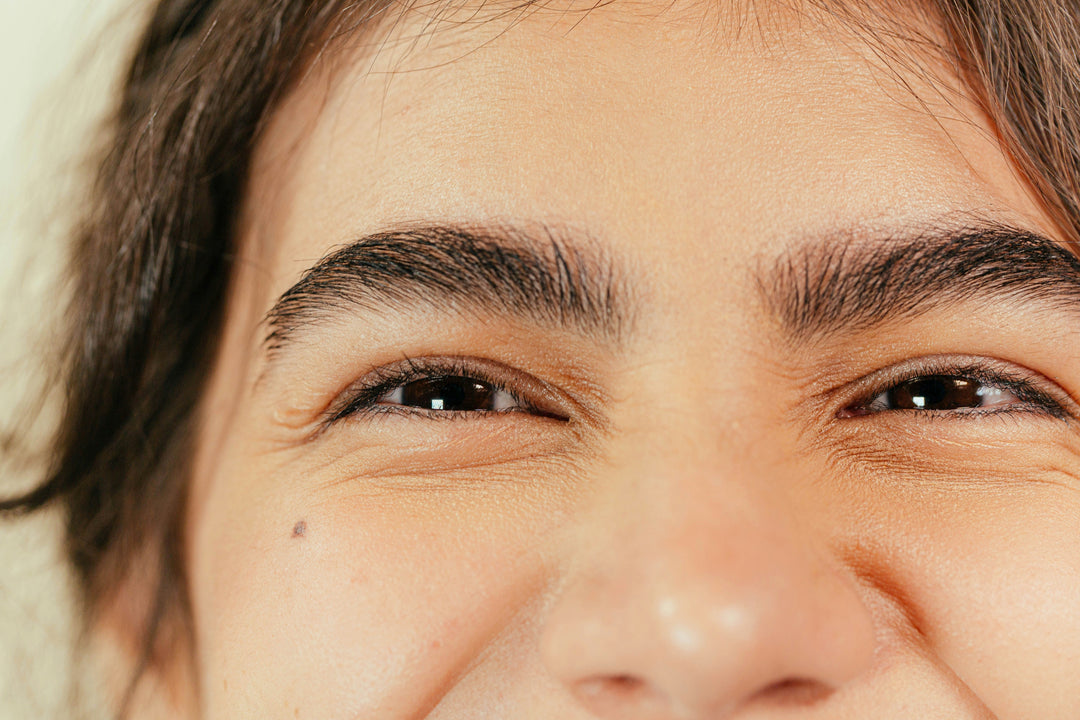 Under-Eye Wrinkles: Why Wrinkles Under Your Eyes Appear and How to Fix the Look of Them