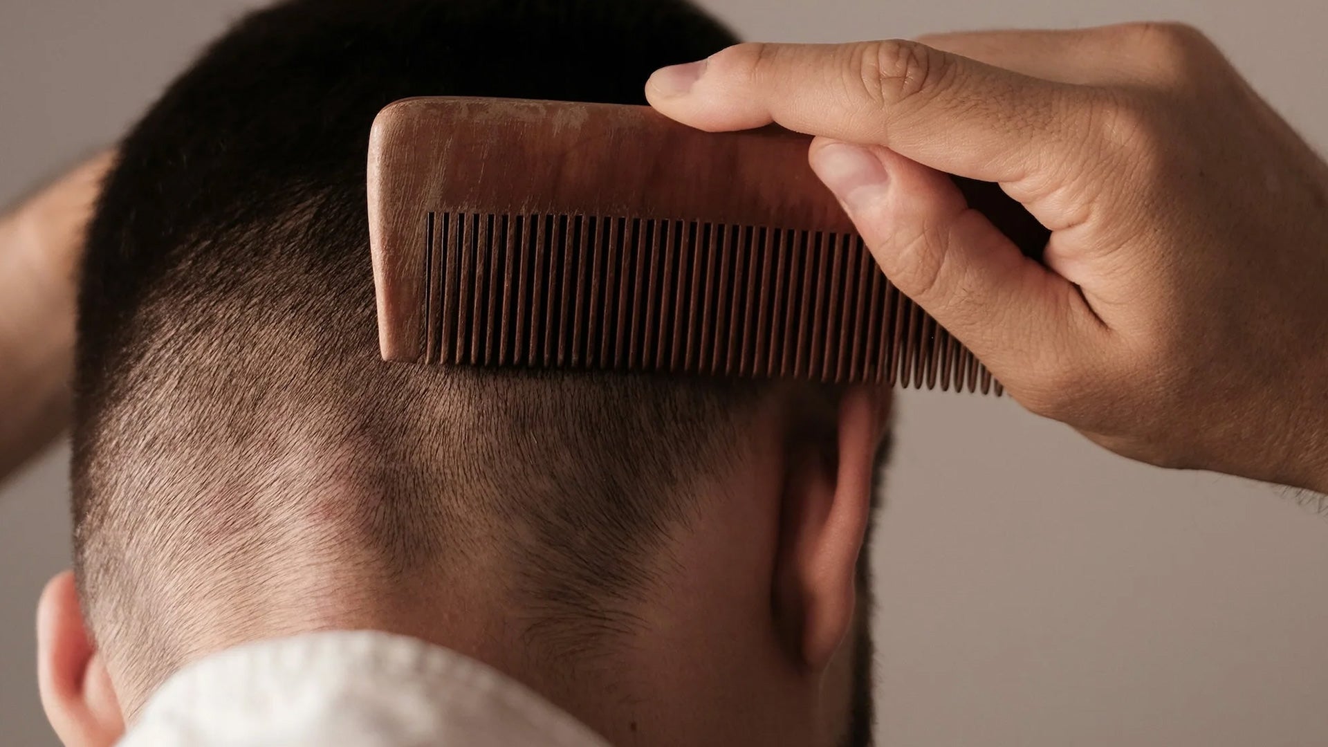 Early Signs of Hair Loss You Shouldn’t Ignore