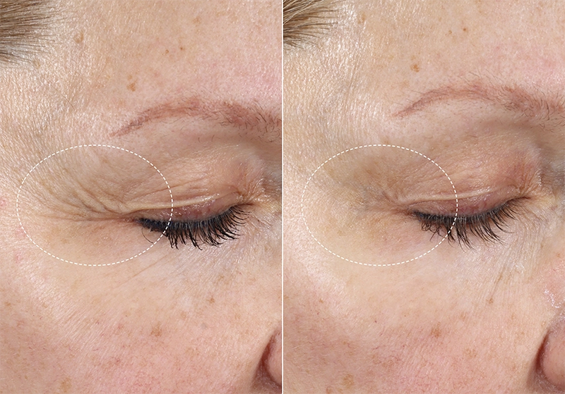 Before and After Image