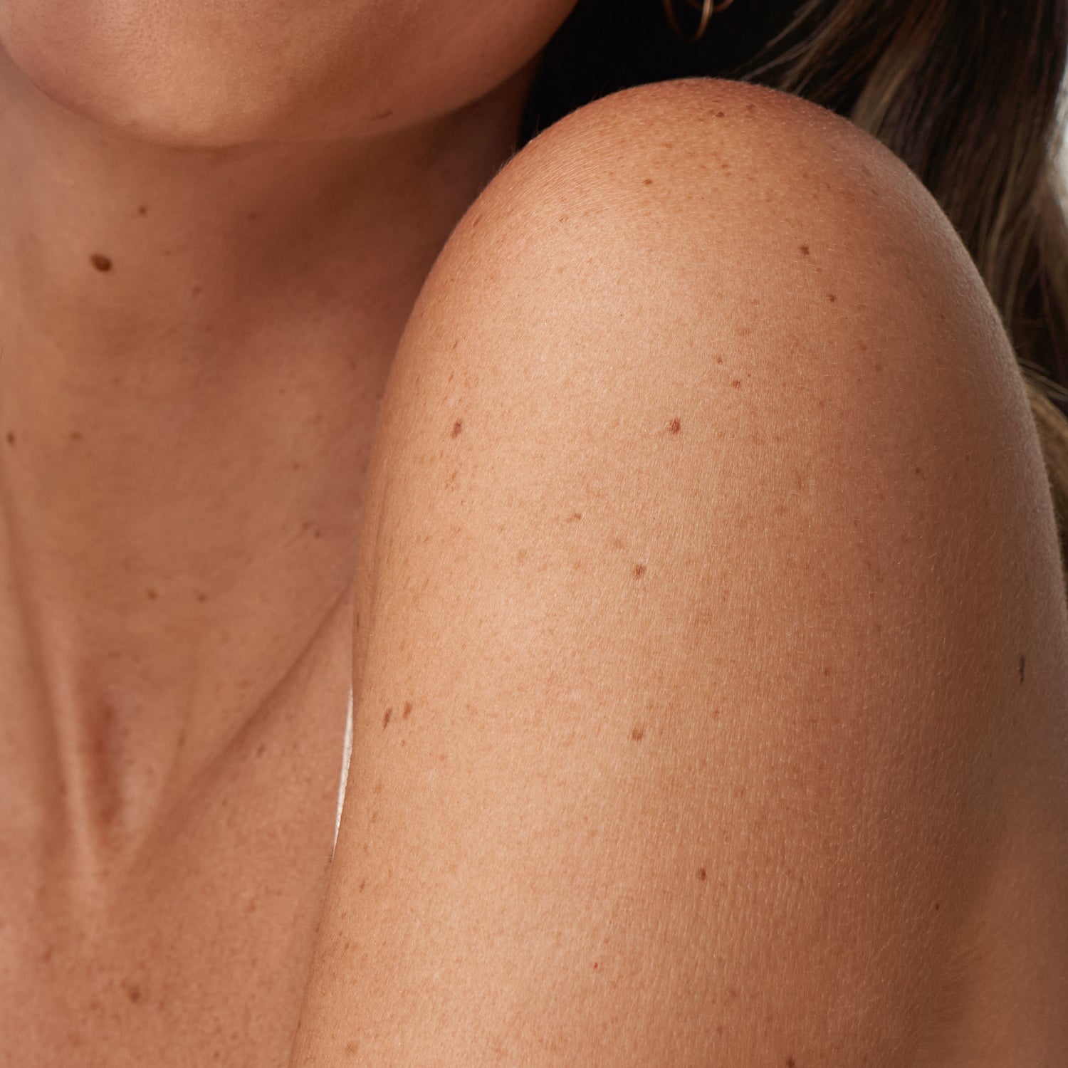 Close-up of a person's shoulder and arm with visible skin texture.