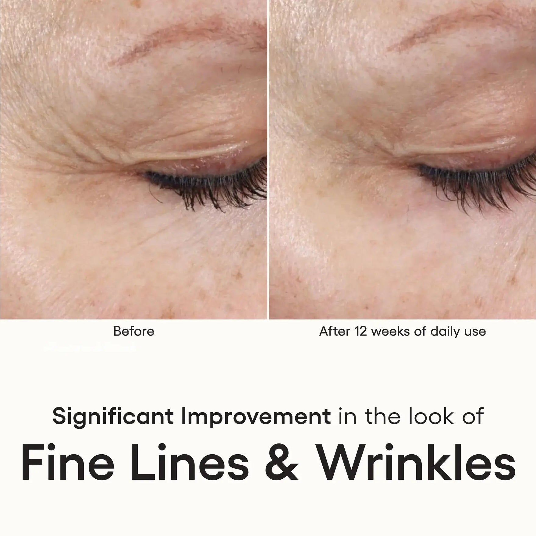 Before-and-after comparison of the eye area with text indicating improvement in the appearance of fine lines and wrinkles after 12 weeks of daily use.