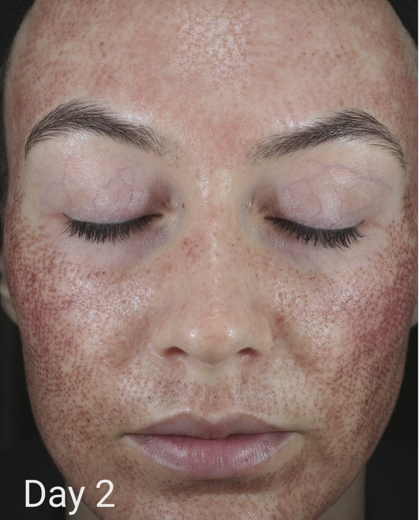 CALM Serum