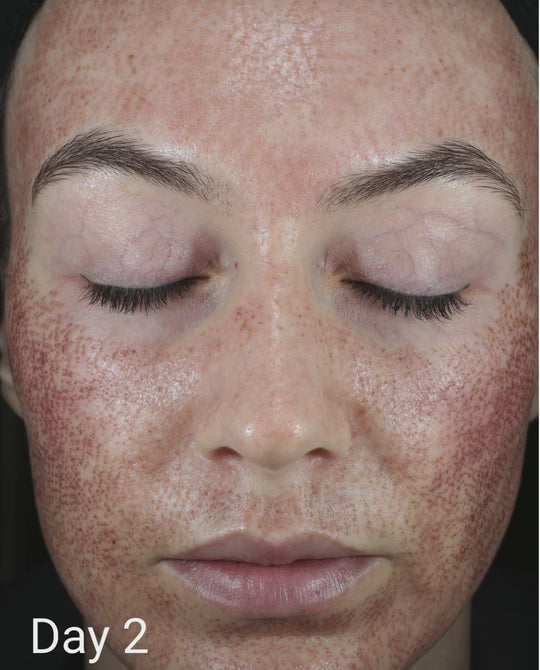 CALM Serum