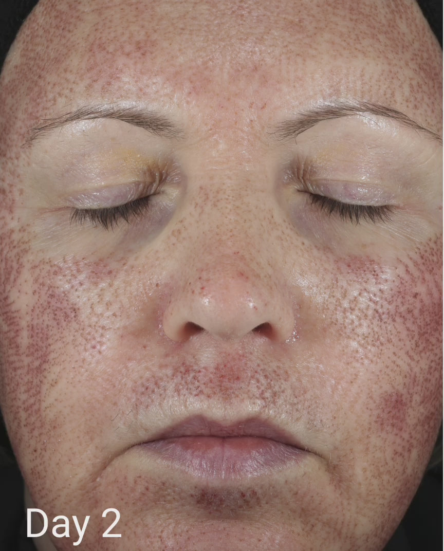 CALM Serum