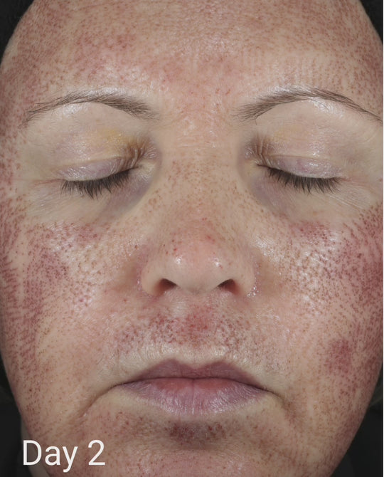 CALM Serum