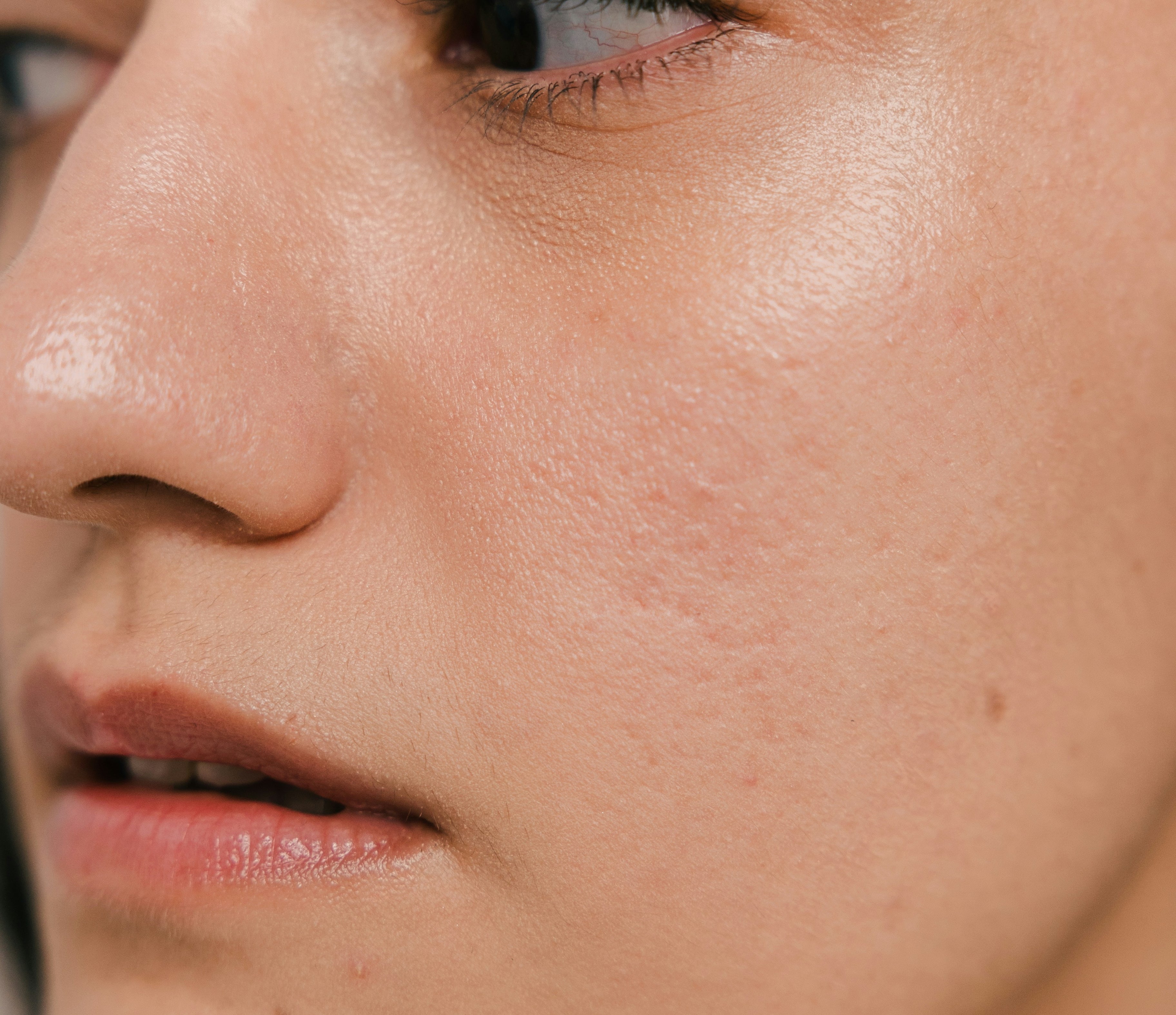 Damaged Skin Barrier? How to Strengthen, Protect, and Renew Your Skin Barrier
