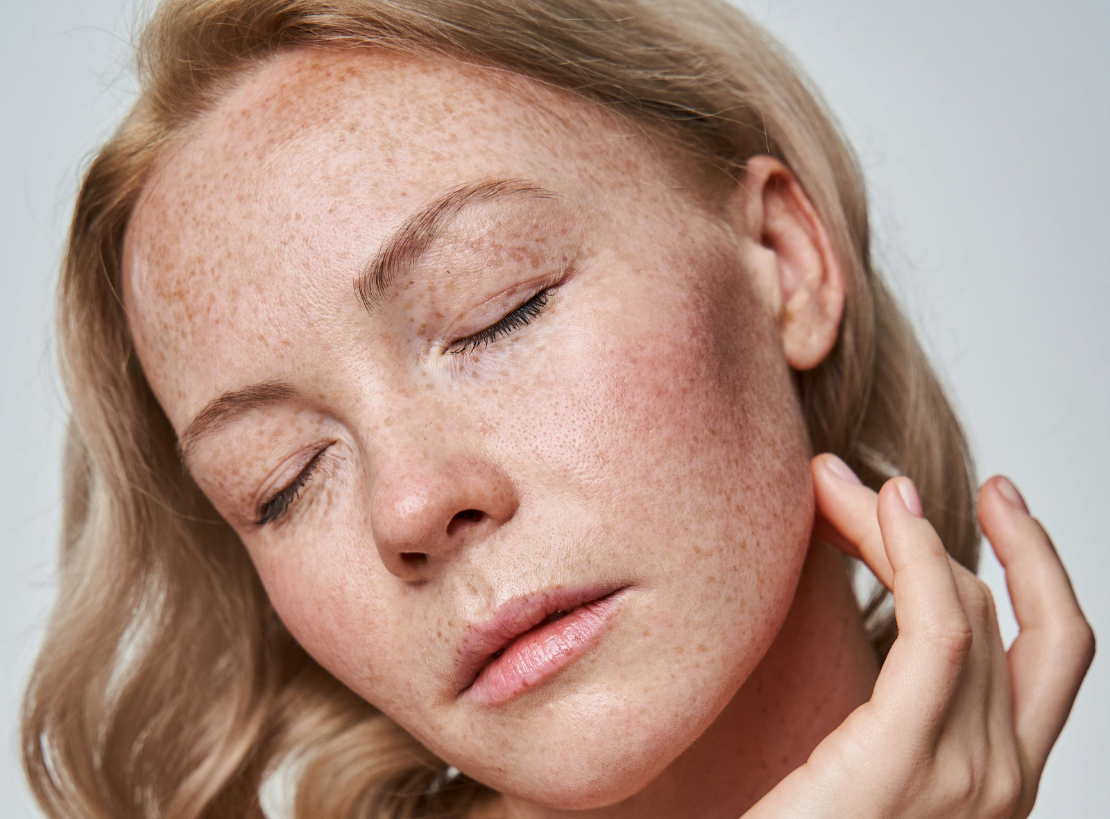 Freckles vs. Sun Spots: What’s the Difference?