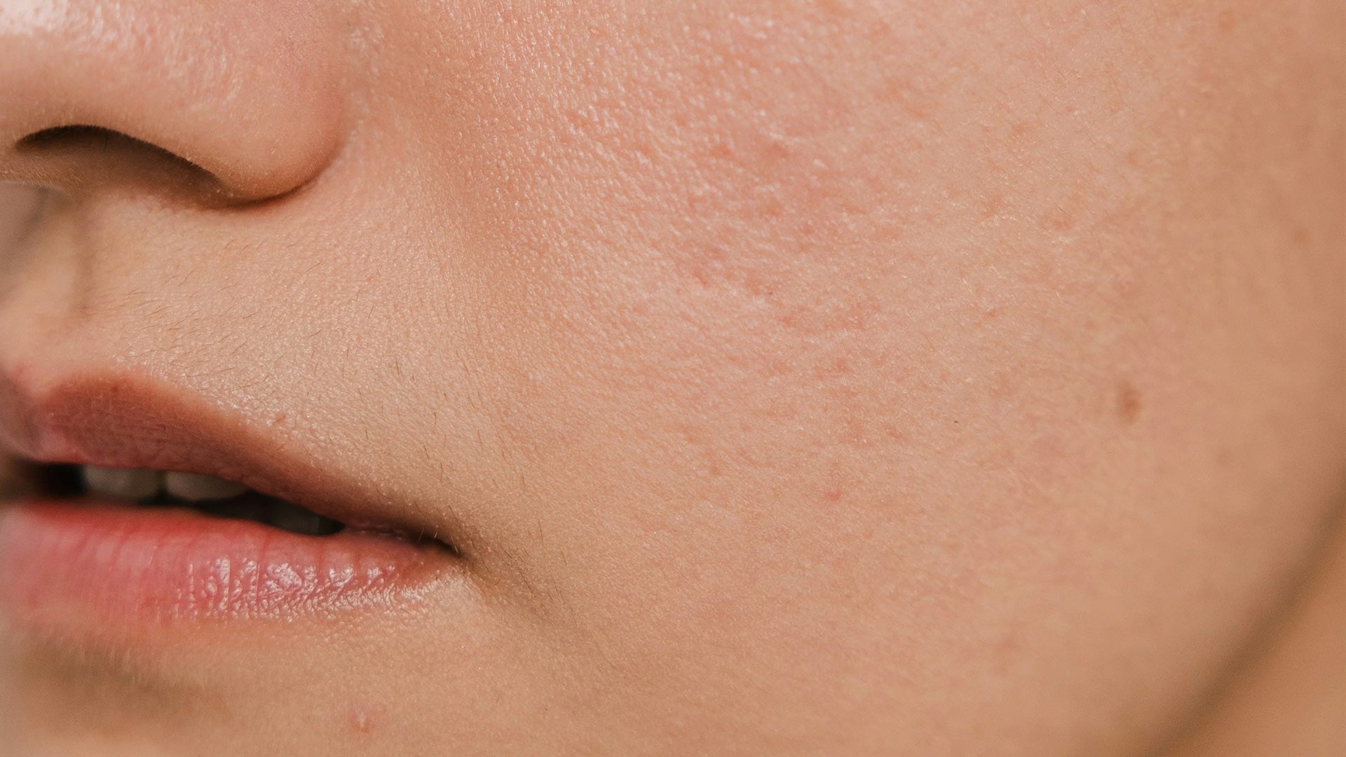 Damaged Skin Barrier? How to Strengthen, Protect, and Renew Your Skin Barrier