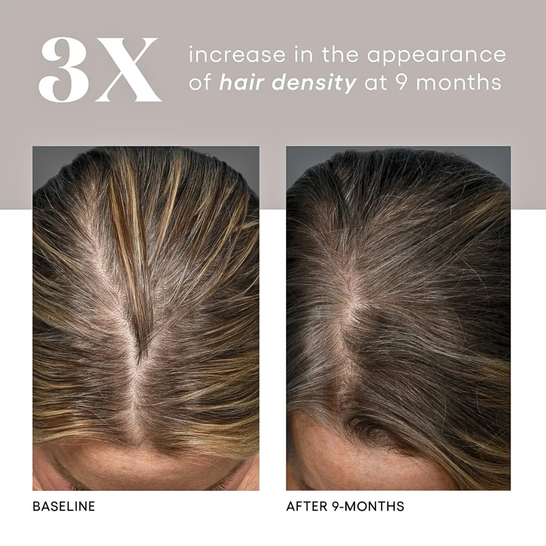 Glow Getters Bundle: INTENSE + HAIR Serum