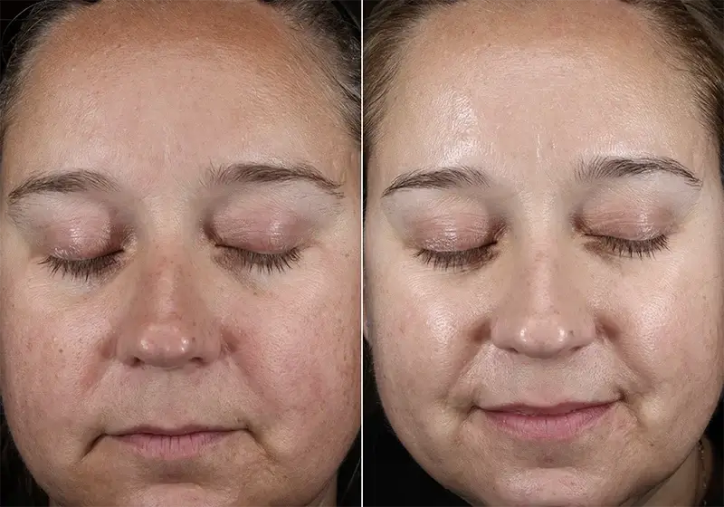 Before and After Image