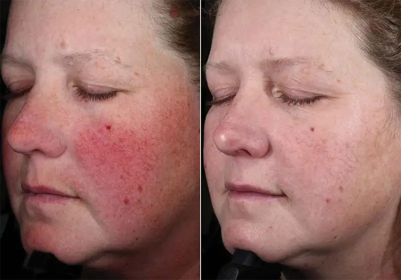Before and After Image