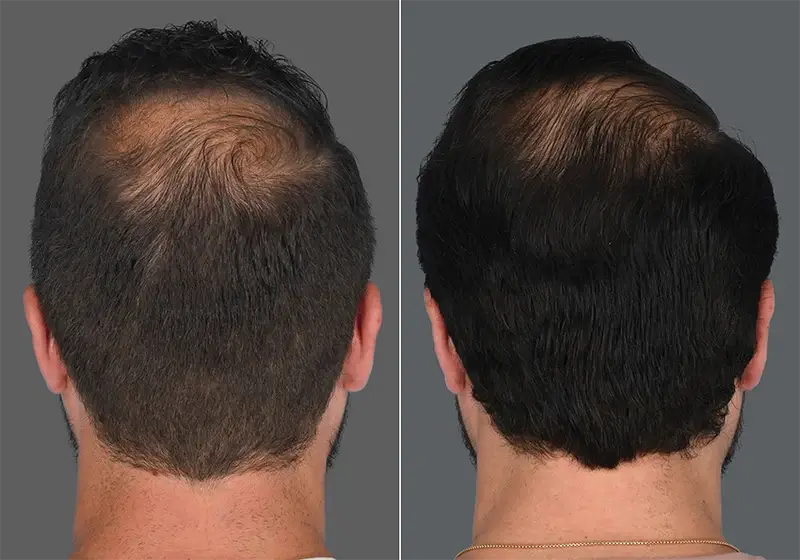 Before and After Image