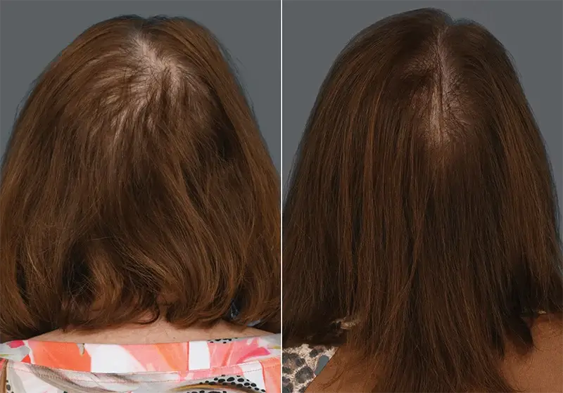 Before and After Image