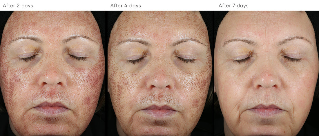 CALM Serum – ( plated )™ Skin Science