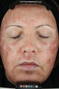 CALM Serum