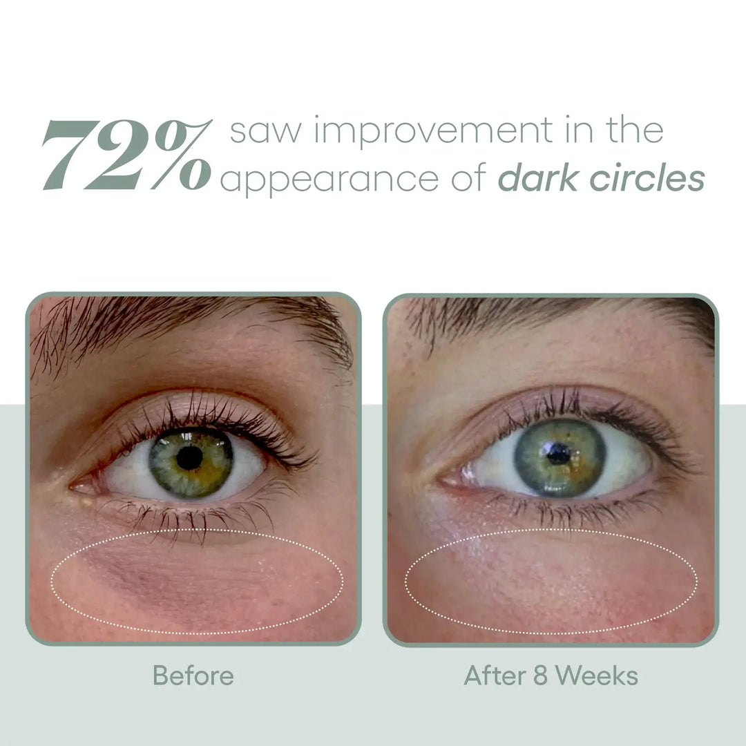 EYE Serum