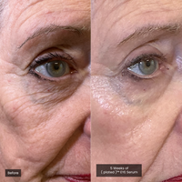 EYE Serum