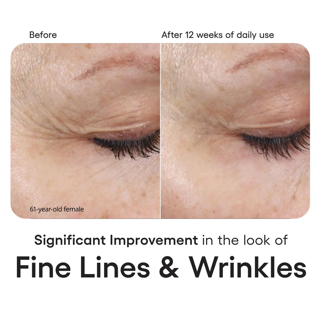 INTENSE  Serum Refill