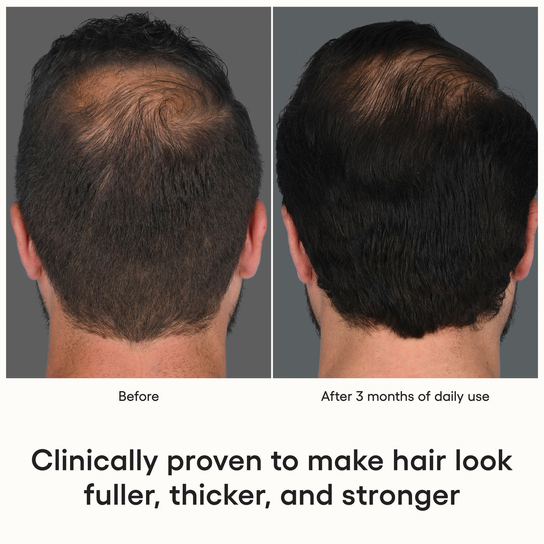 Shop HAIR Serum Today | Exosome Hair Care Products – ( plated