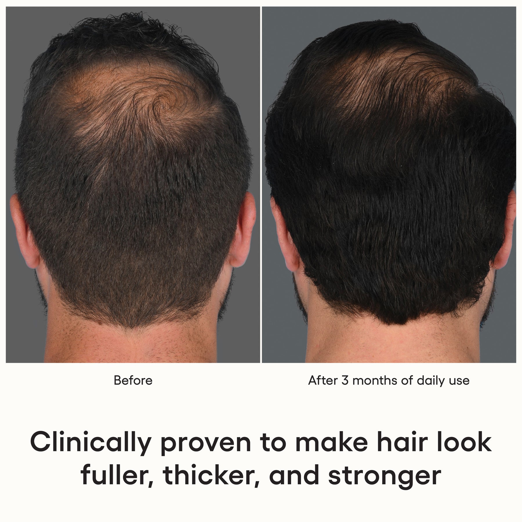 Shop HAIR Serum Today | Exosome Hair Care Products – ( plated